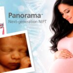 ADN Fetal Panorama: La prueba más segura para conocer la salud de tu bebé